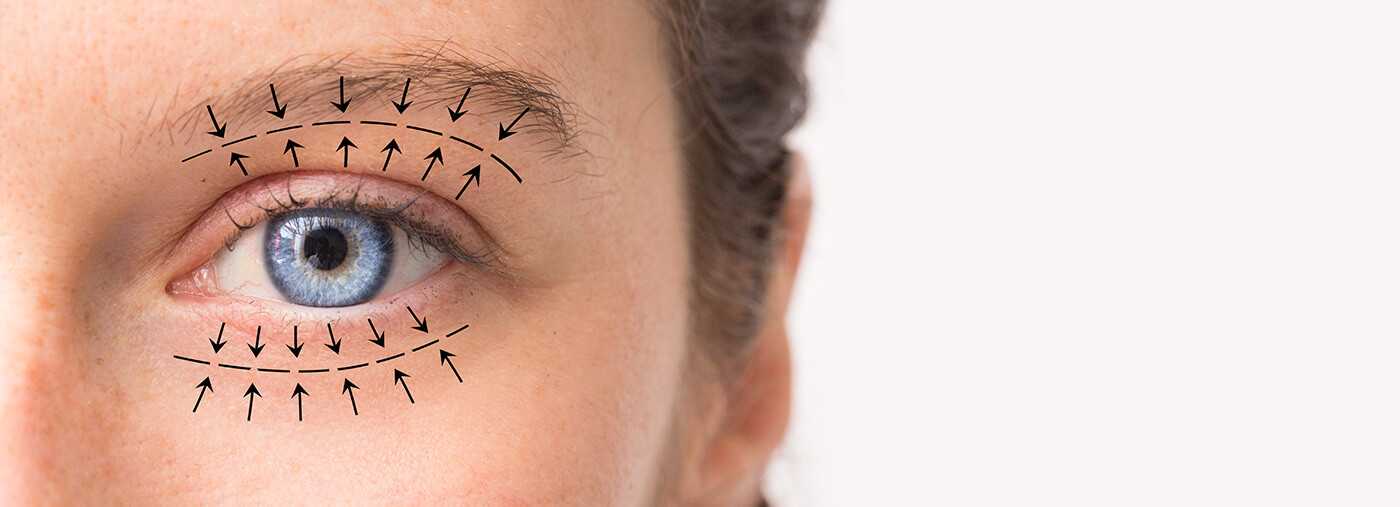 Eyelid surgery - Warsaw and Płock | OpenMed Medical Centre