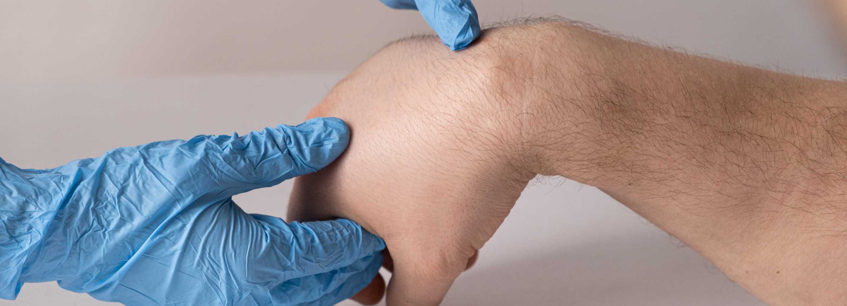 Lipoma removal Warsaw and Płock | OpenMed Medical Centre