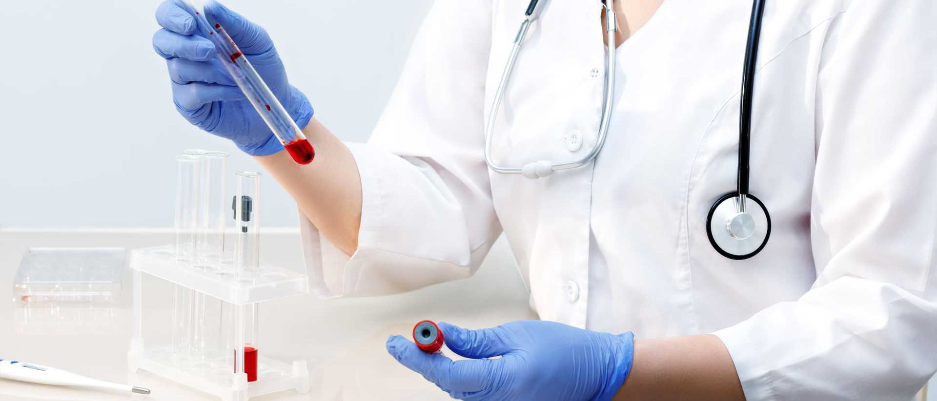 Hematolog - kiedy warto umówić się na konsultację? Czym zajmuje się hematolog i jakie ma znaczenie w diagnostyce chorób krwi?