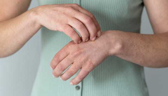 Swędząca skóra bez wysypki – kiedy warto zgłosić się do dermatologa?