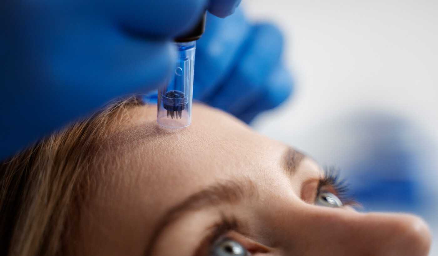 Usuwanie zmian skórnych (PLASMA IQ, łyżeczkowanie, wymrażanie) Warszawa | OpenMed
