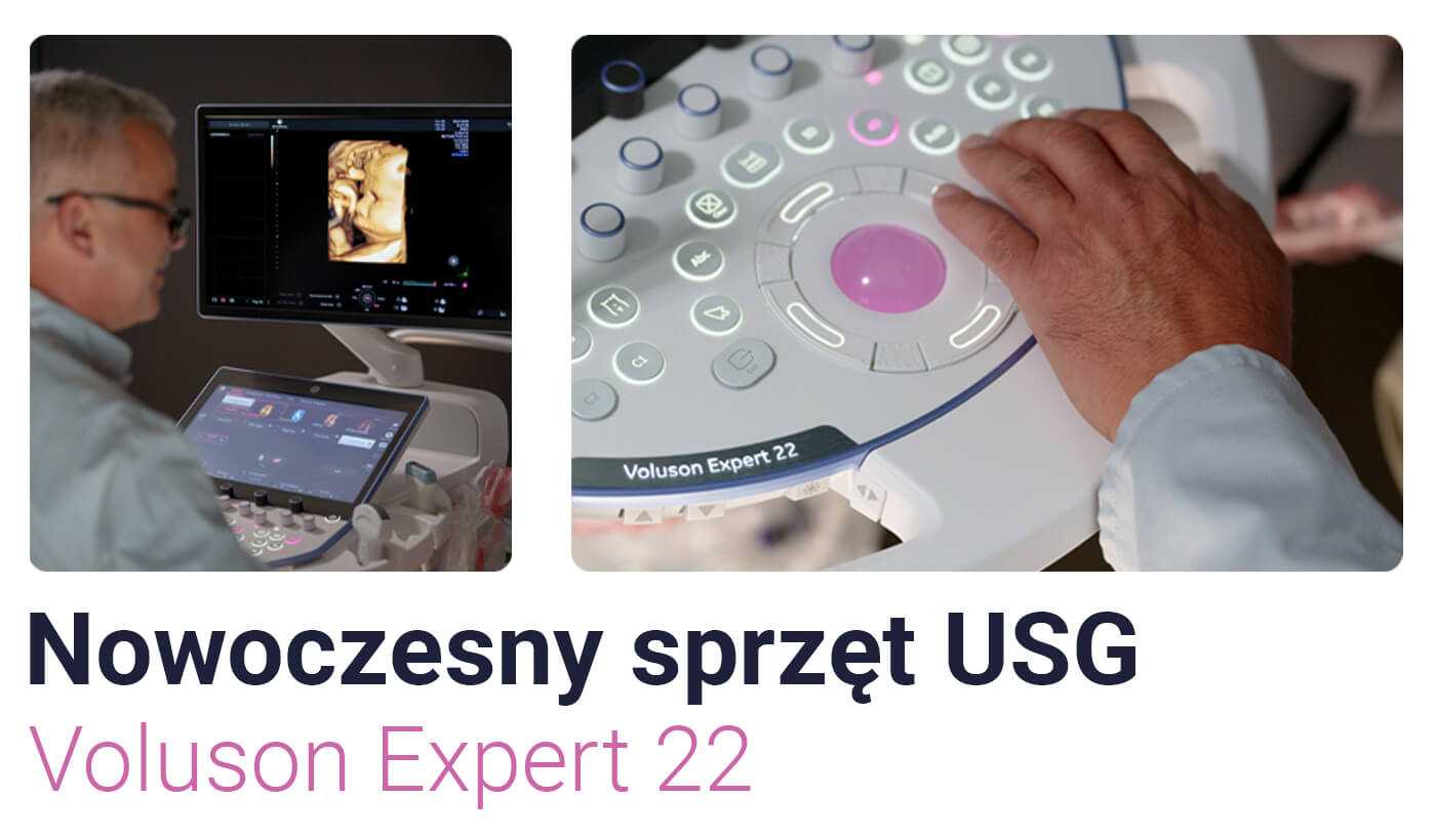 Pregnancy Ultrasound Diagnostics | GE VOLUSON Expert 22 | Warsaw - OpenMed