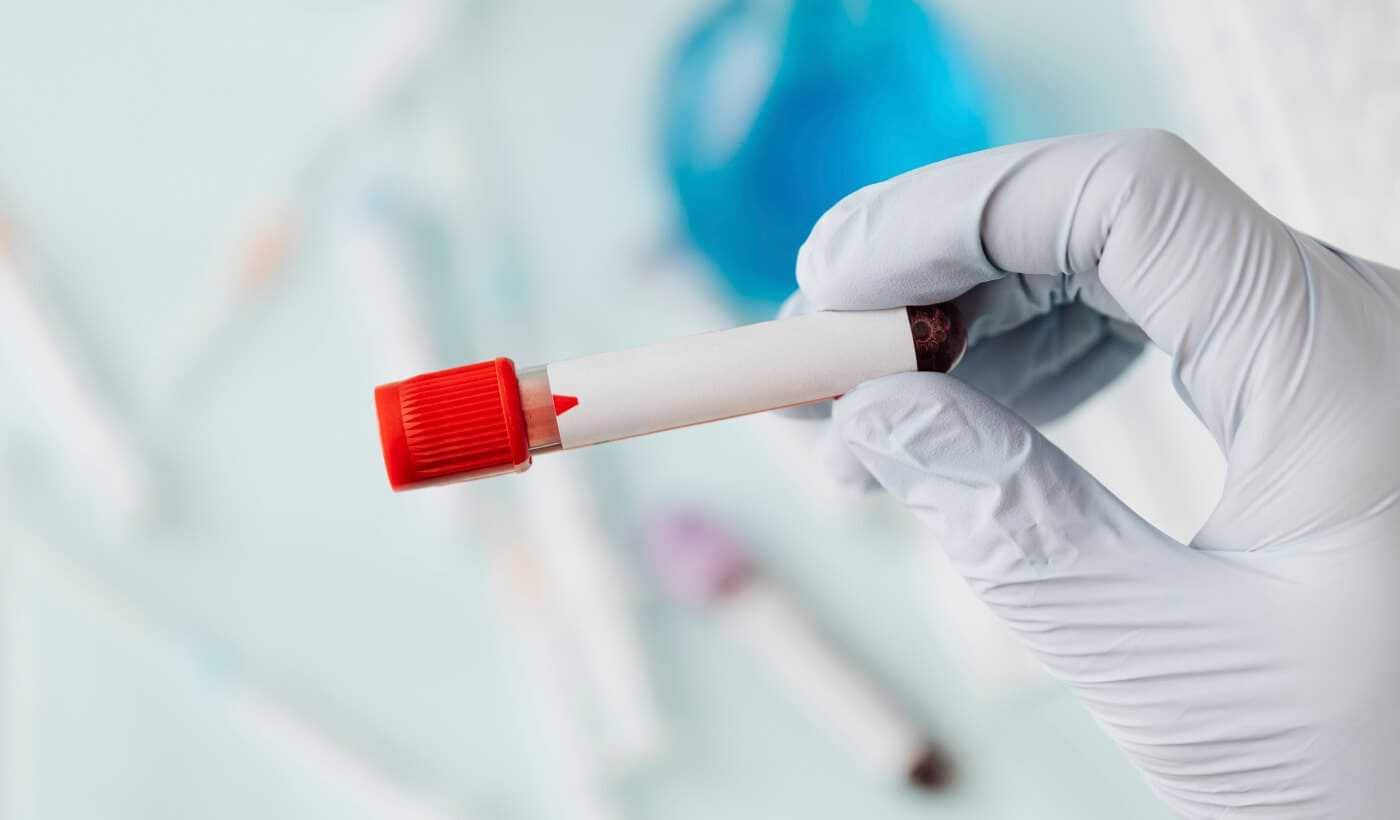 Coagulation disorders diagnosis Warsaw Wola and Płock | OpenMed