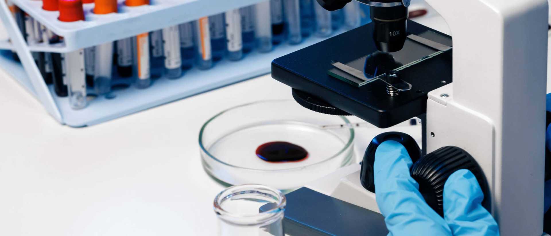 Małopłytkowość - przyczyny, objawy i diagnostyka obniżonej liczby płytek krwi | OpenMed