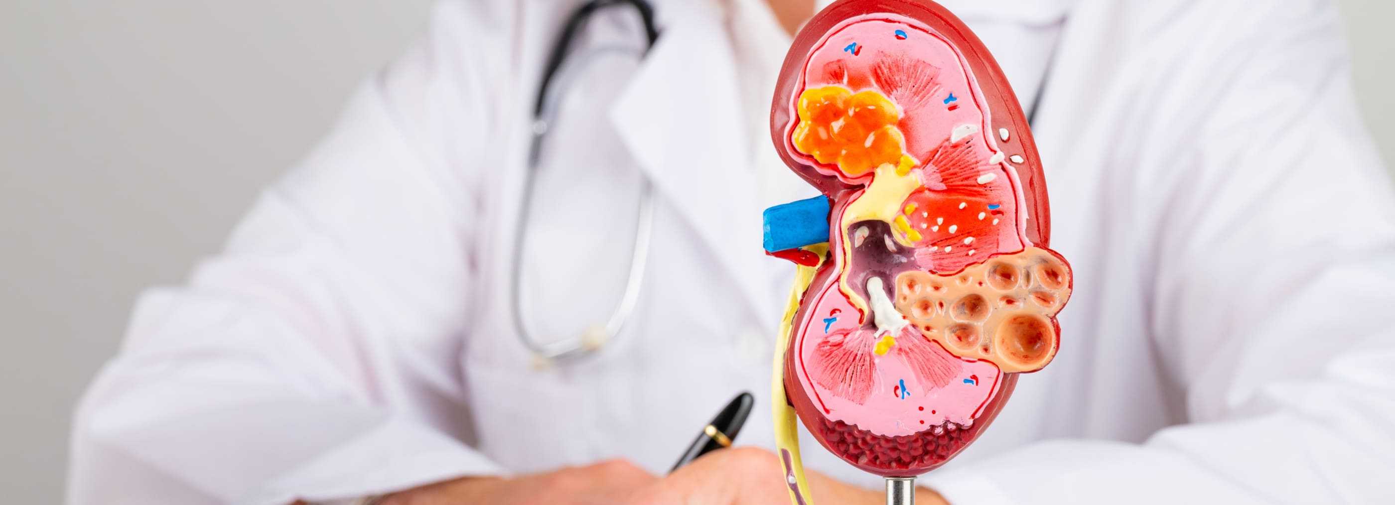 Kidney stone removal Warsaw and Płock | OpenMed Medical Centre