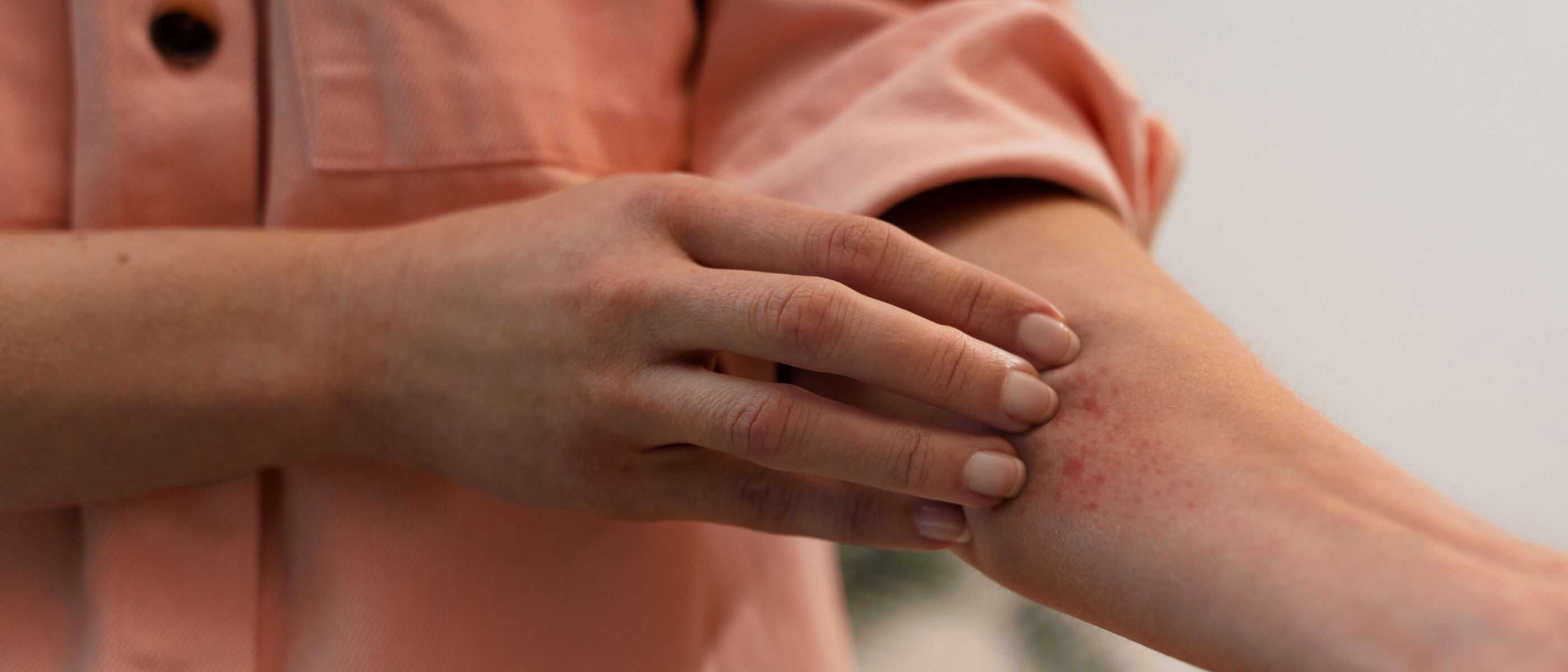 Atopic dermatitis (AD) and eczema | Warsaw | OpenMed Medical Centre