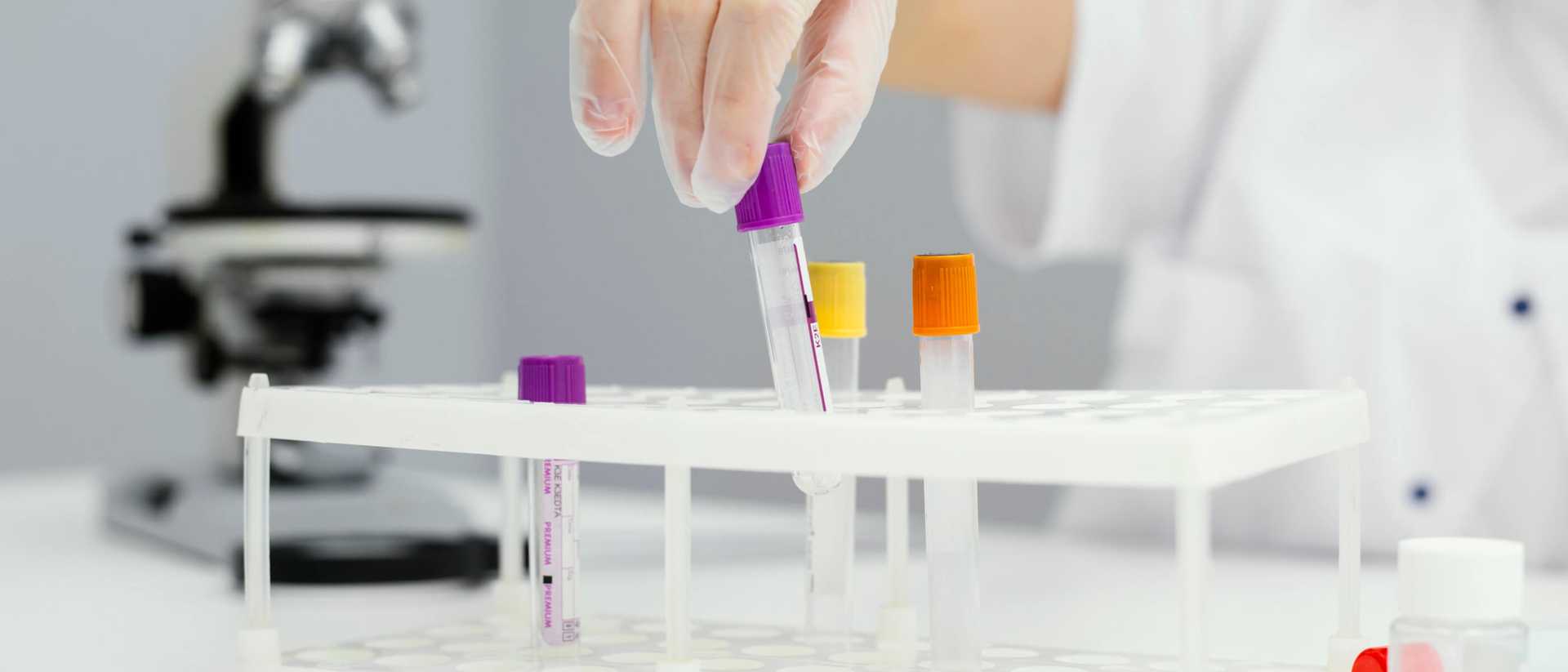 Pakiety badań laboratoryjnych - jakie warto wykonać? Pakiety diagnostyczne w OpenMed