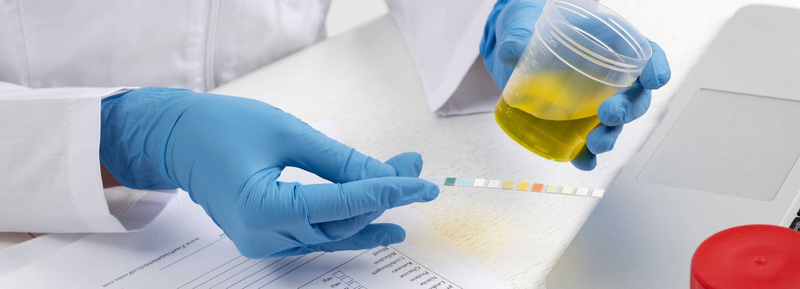 Białko w moczu – diagnostyka i leczenie Warszawa | OpenMed Centrum Medyczne